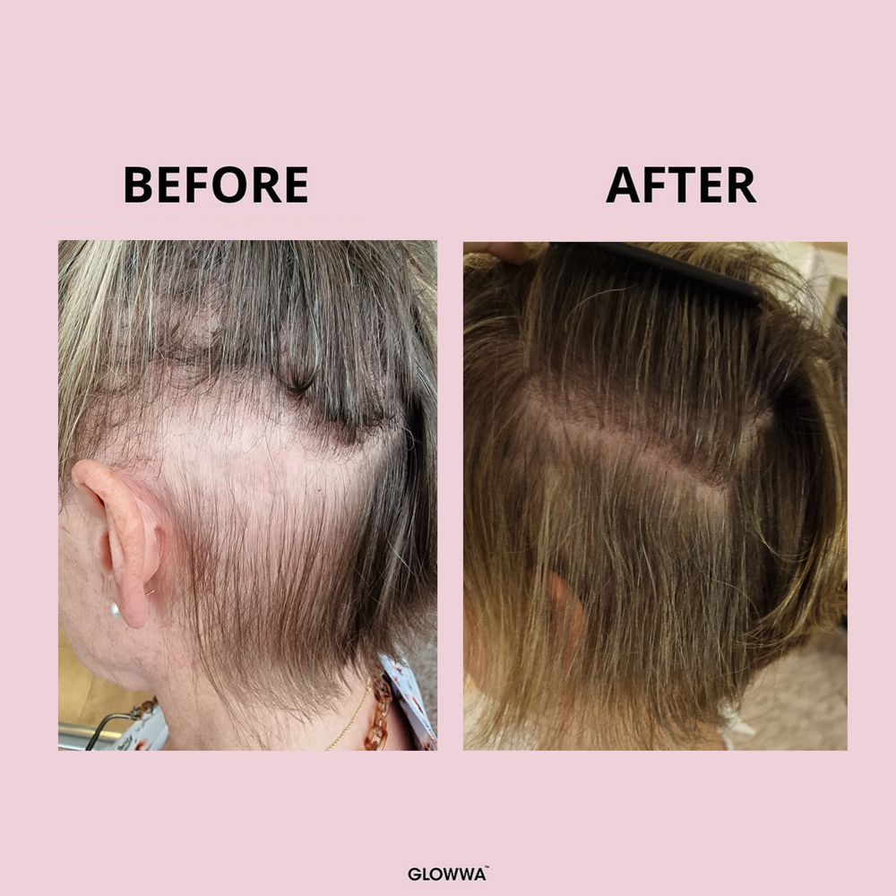 GLOWWA HAIR FOOD – Витамини за Коса (за 1 месец)