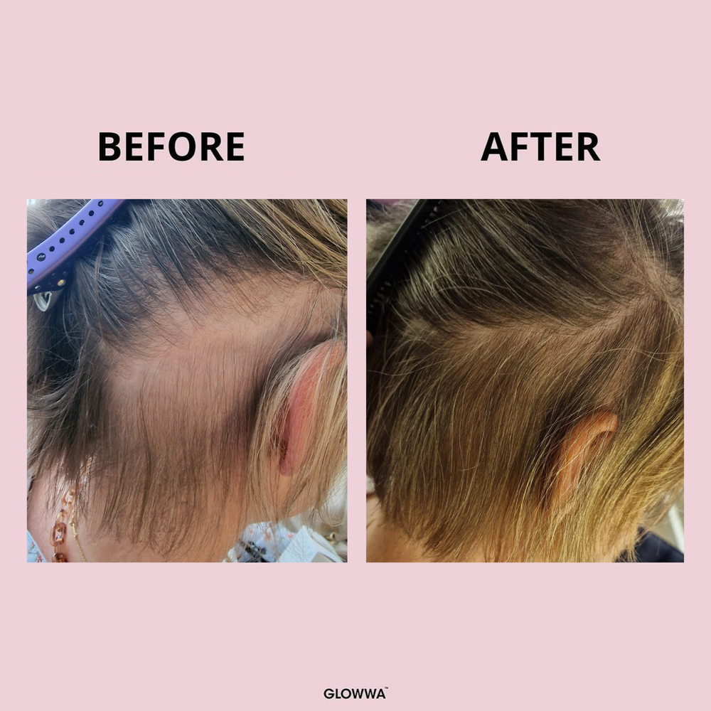 GLOWWA HAIR FOOD – Витамини за Коса (за 1 месец)