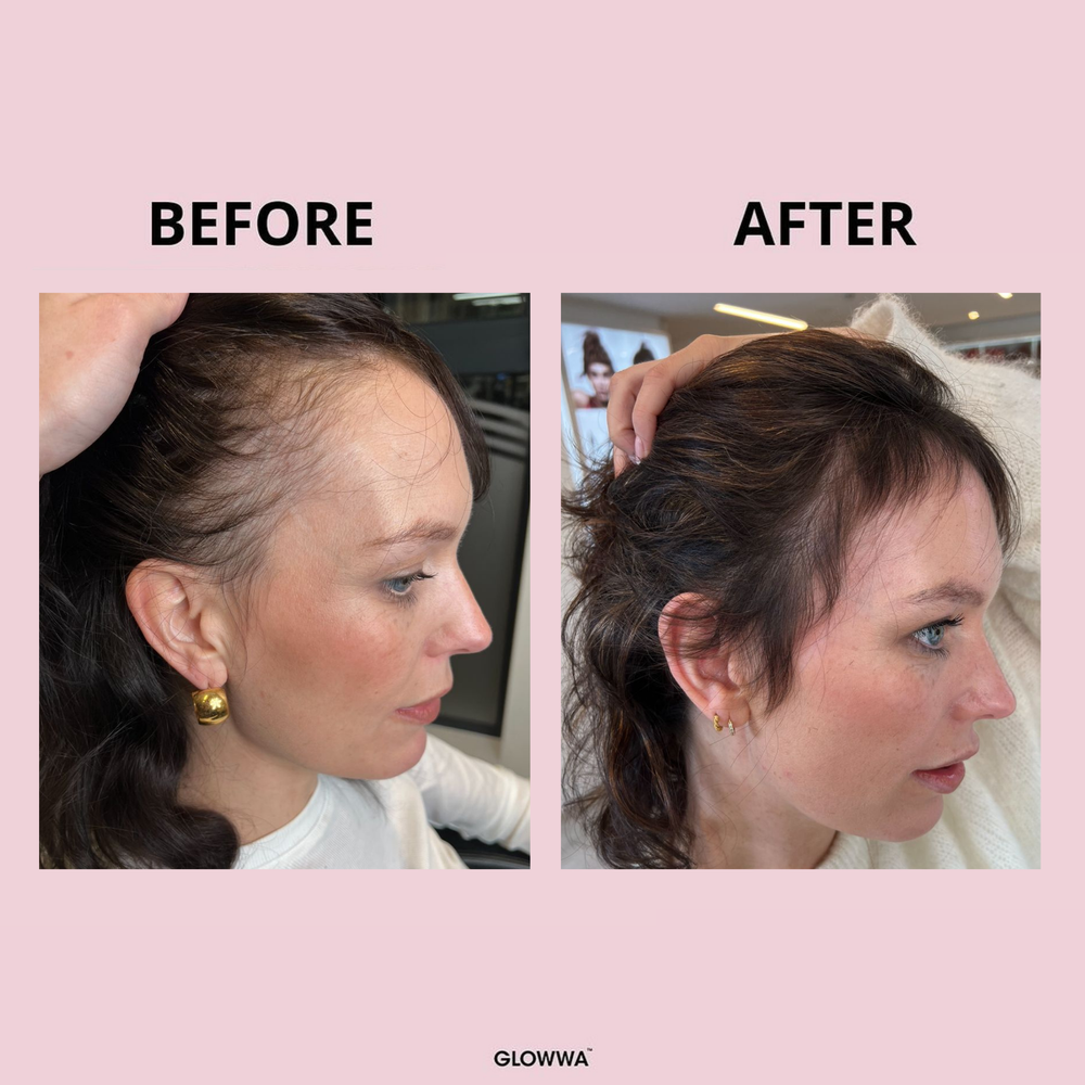 GLOWWA HAIR FOOD – Витамини за Коса (за 1 месец)