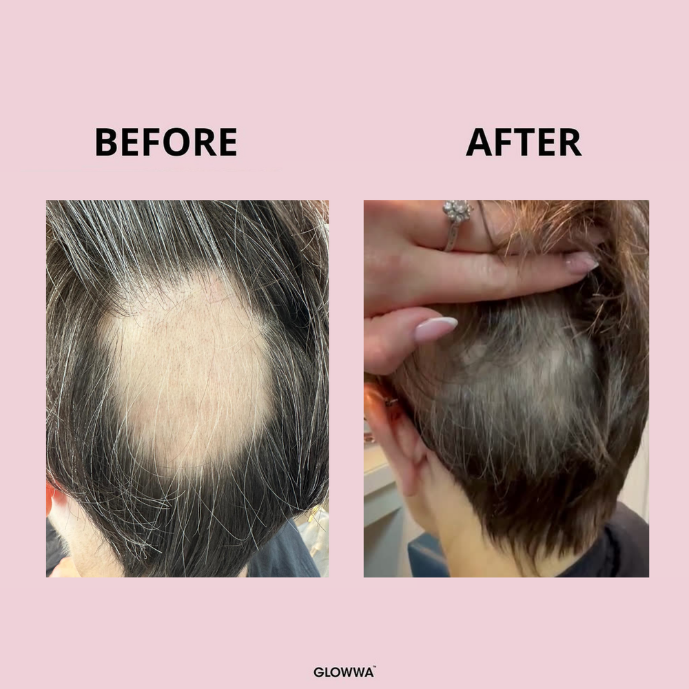 GLOWWA HAIR FOOD – Витамини за Коса (за 1 месец)