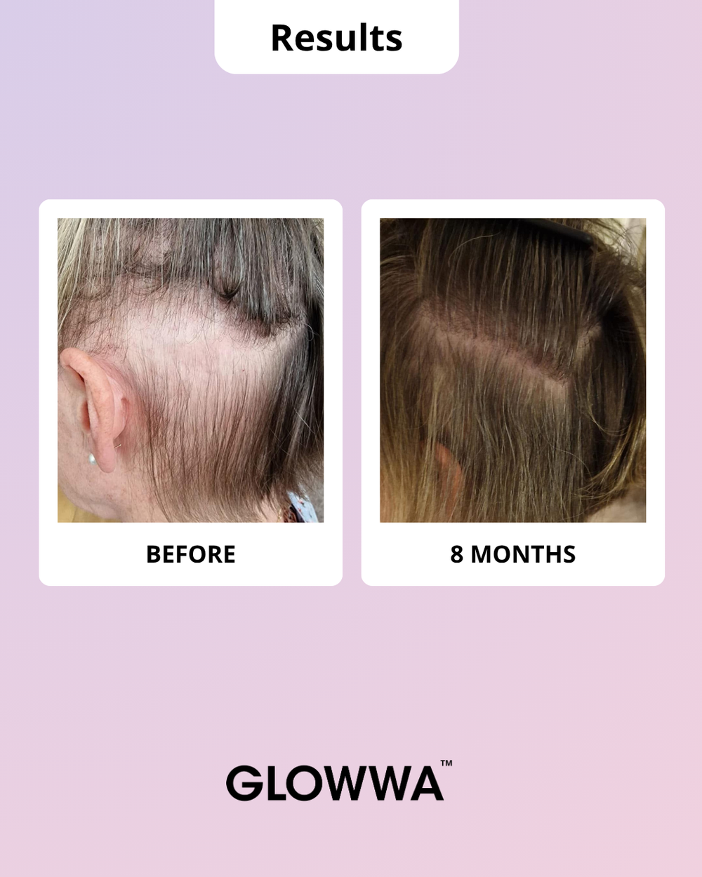 GLOWWA HAIR FOOD | MENO – Витамини за Коса (за 1 месец)