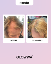 GLOWWA HAIR FOOD | MENO – Витамини за Коса (за 1 месец)