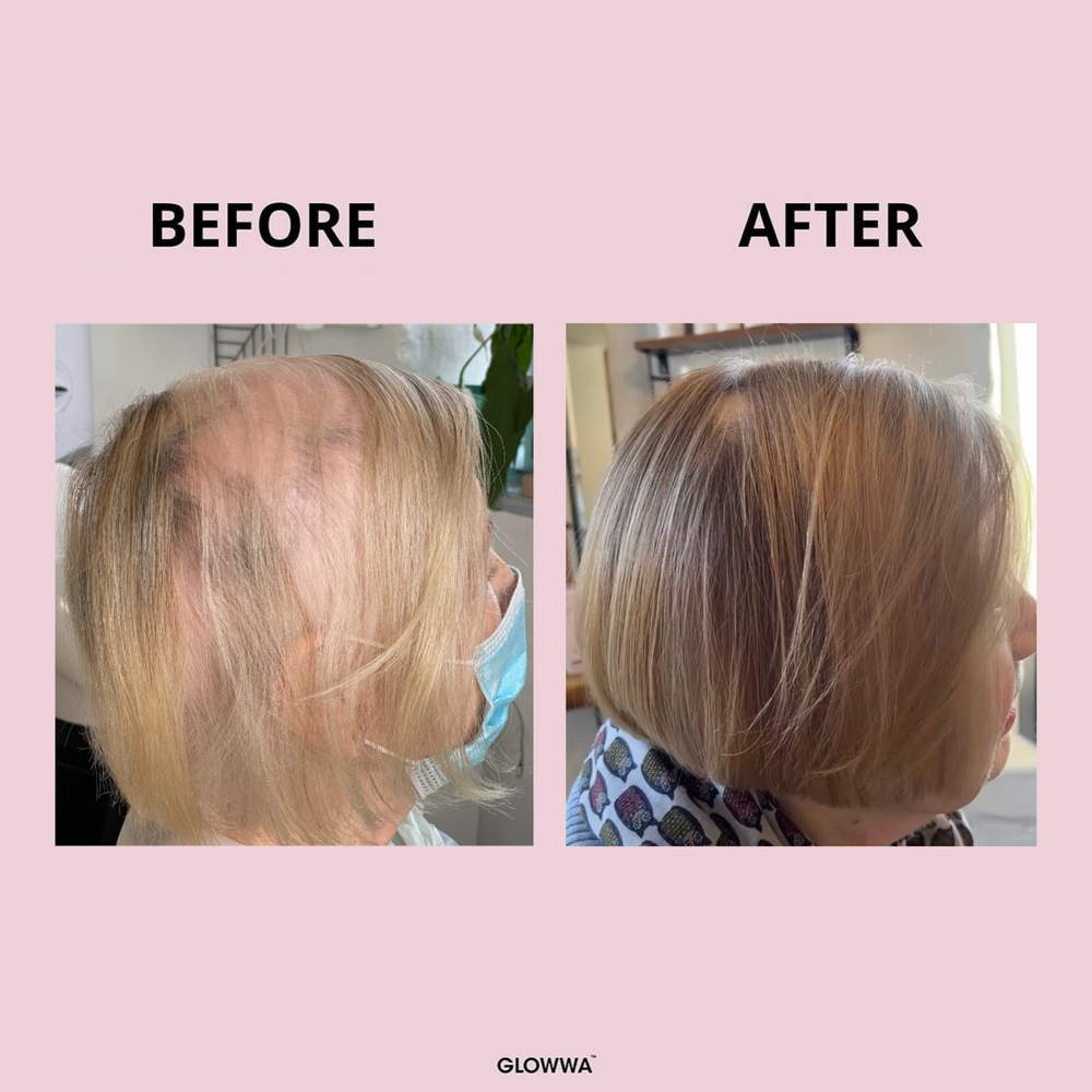 GLOWWA HAIR FOOD – Витамини за Коса (за 1 месец)