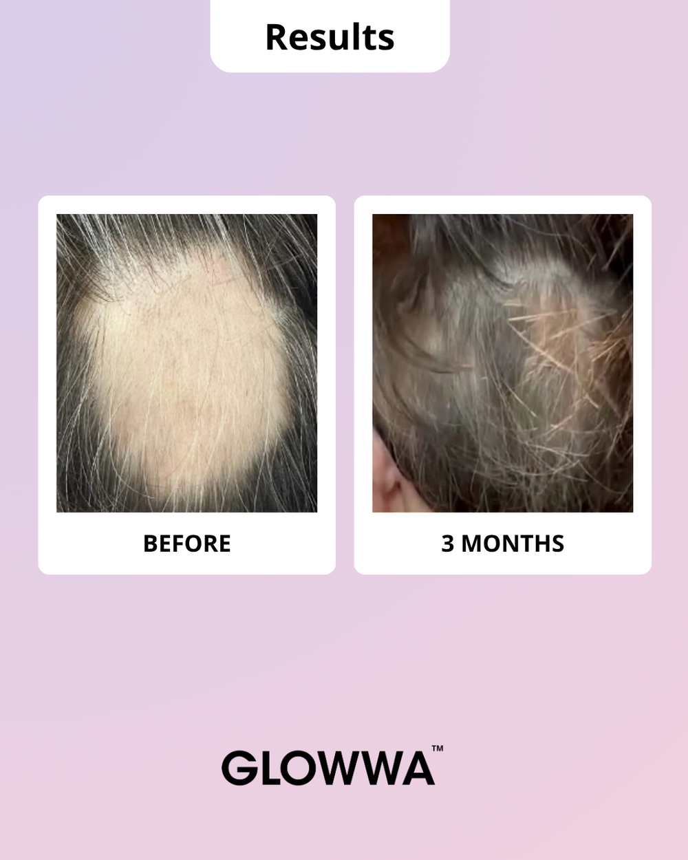 GLOWWA HAIR FOOD | MENO – Витамини за Коса (за 1 месец)