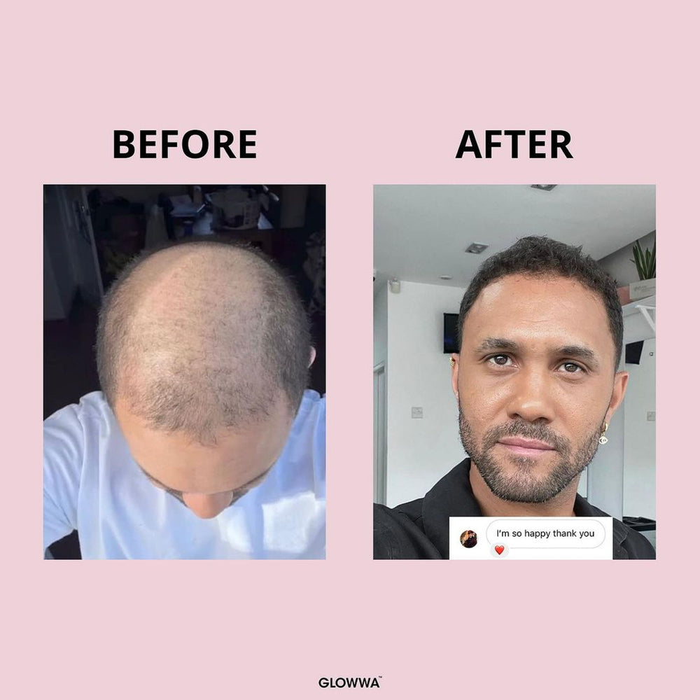 GLOWWA HAIR FOOD – Витамини за Коса (за 1 месец)